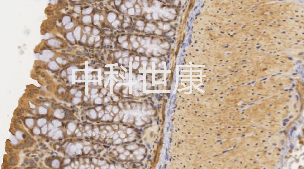 免疫组化IHC的操作方法——南京中科世康生物(图1)