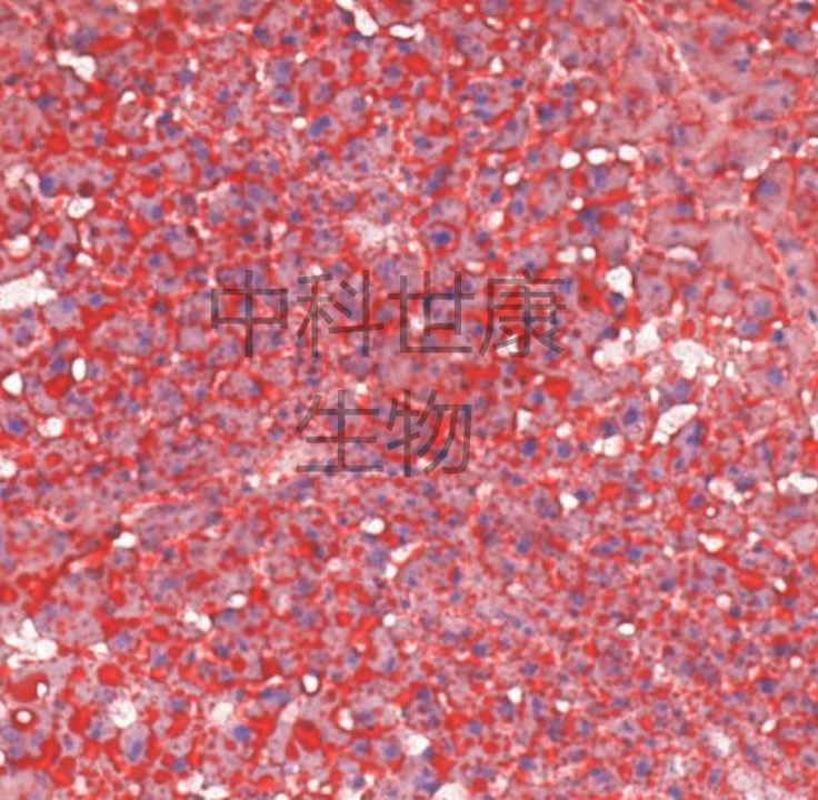 油红O脂类染色法实验分享(图1)